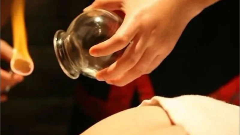 The Best Hijama Course